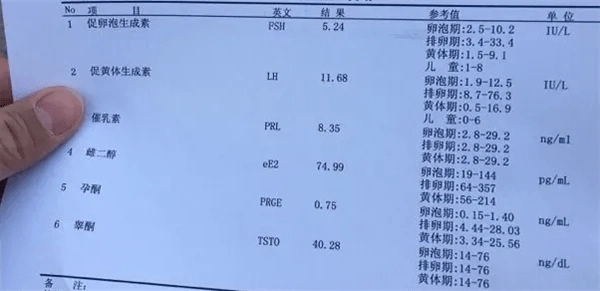 性激素六项检查结果怎么看?附性激素六项正常值