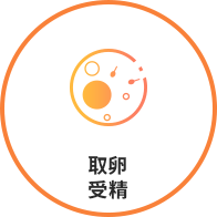 格鲁吉亚试管婴儿取卵受精