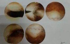 泰国医疗环境变迁记-一位助孕顾问的十年亲历与肺腑忠告