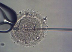 格鲁吉亚通过什么法案？海外助孕顾问Lina的8年亲历回忆与避坑指南