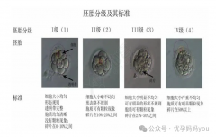 试管婴儿胚胎级别大揭秘，优质胚胎如何养成？？？