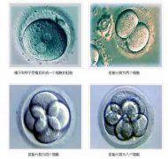 泰国曼谷医院试管婴儿机构胚胎等级是如何划定的？