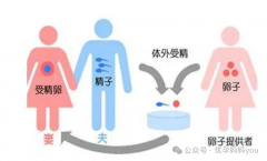 高龄女性做供L试管婴儿需要注意那些事项，平均成功率70%并非骗人