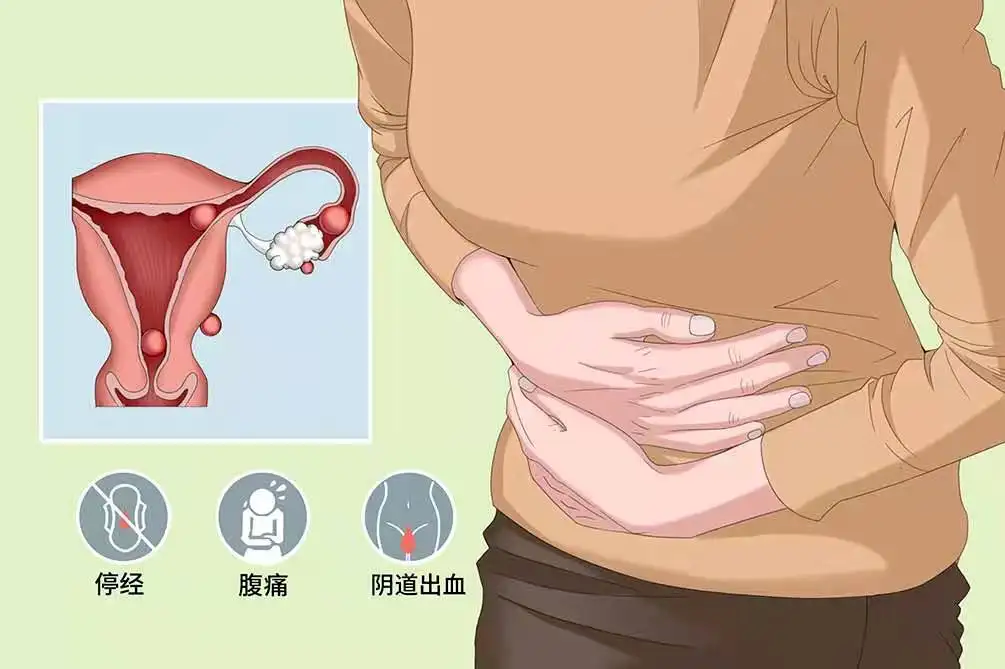 分享宫外孕早期常见的六个征兆，如有发现需尽快就医