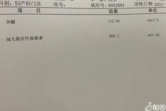 孕吐早晚跟男女有没有关答案在这，和胎儿性别关系剖析